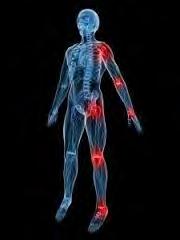 Nonodontogenic Referred Pain In this pain originates from deep tissues, muscles, joints, ligaments, etc. and is perceived at a site away from its origin.