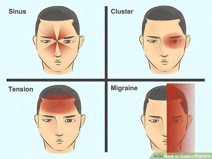 Neurovascular Toothache The most common neurovascular pain in the mouth and face is migraine. This category of pain includes three subdivisions of primary headache. These are: i. Migraine ii.