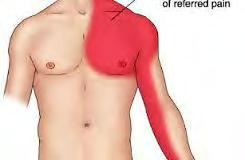 CARDIAC TOOTHACHE Severe referred pain felt in mandible and maxilla from area outside the head and neck region is most commonly from the heart.