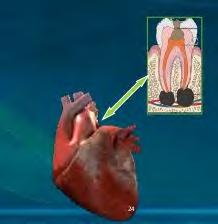 Sometimes, patient presents dental complaints as the chief complaint rather than having pain in substernal region, it creates confusion in diagnosis for dental pain.
