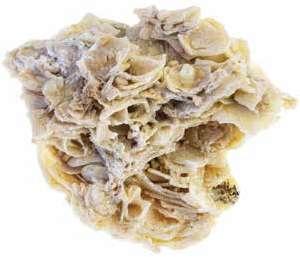 الصخور الرسوبية الكيميائية الحيوية Biochemical Sedimentary Rocks تتكو ن هذه الصخور من رسوبيات نتج ت بفعل عمليات حيوية إذ تأخذ الكائنات الحية البحرية المعادن الذائبة في الماء لت كو ن الجزء الص ل ب من