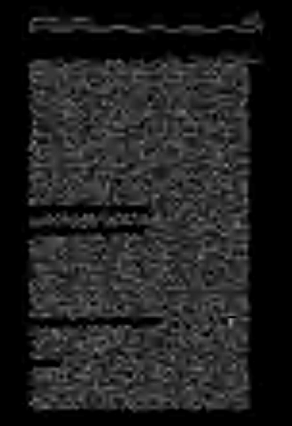 ةيفصتلا قيرطنعامإو.