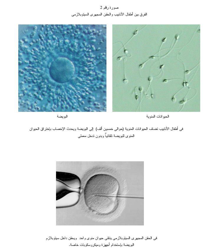 الدكتور فالح األسدي المحاضرة الرابعة ارتفاع نسبة هرمون اللبن Hyperprolactinaemia هناك اسبابا كثيره الرتفاع نسبة هرمون Prolactin في الدم ويجب اوال الب Pdf Free Download