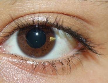 )تاری دید قرمزی چشم ترومای چشمی بیماران دیابتی( )با تاکید بر شرایط و نحوه