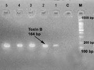 aureus isolates. Figure 7-The PC amplification products of. aureus toxin B gene (164bp) separated on 1.