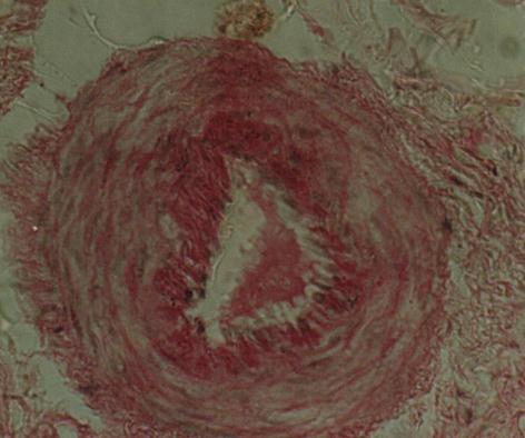 صبغة اكروم اثاثية B D صورة )( مقطع مستعرض مشريان اتاجي اعضمي يوضح اتركيب