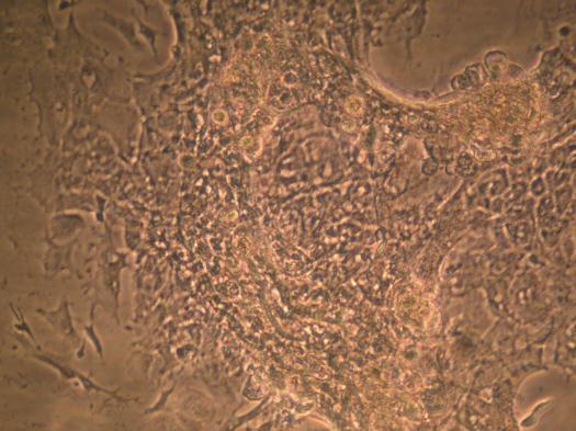 fibroblastic cells0x Fig.