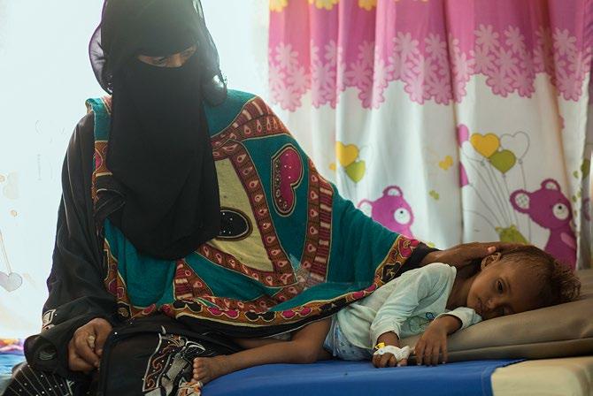مجال الهدف 1: بقاء كل طفل على قيد الحياة وازدهاره قبل وبعد... حين وصلت سابا إلى مركز التغذية العالجية في اليمن كانت حياتها في خطر.