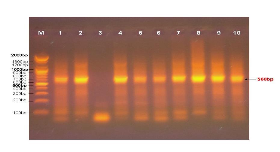 09 كما في الصورة )9) و 6 عينات فقط كانت سالبة أي بنسبة 10.90 حيث استخدمت طريقة Nested PCR وذلك لتحديد طفيلي اللشمانيا ونوعه وقد أظهرت النتائج للعينات الموجبة ان 47 عينة هي L.major أي بنسبة %95.