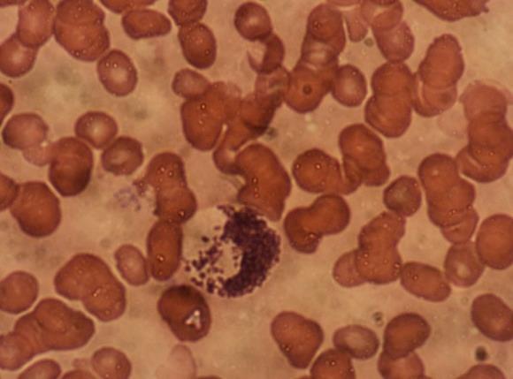الصورة )3 ( الطور غير المسوط Amastigote form داخل الخلية البلعمية في عينة مأخوذة من حافة اآلفة الجلدية ألحد المرضى المصابين