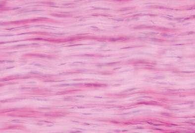 2. Regular: fibers arranged parallel to each other in a specific orientation اتجاه محدد with flattened fibroblasts dispersed between them.