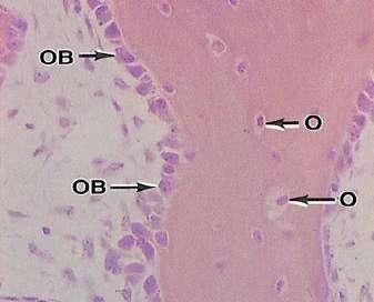 Osteoblasts secret the organic matrix from its surface in contact with old bone, creating an area of yet unmineralized bone called Osteoid Later on, osteoblasts will deposit the inorganic components
