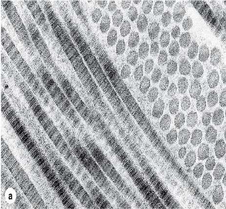 Collagen fibers as seen by TEM (a) and LM (b). Note the striation seen under the EM. Also note the pink color of the collagen fiber in (b). The arrows point to nuclei of fibroblast.
