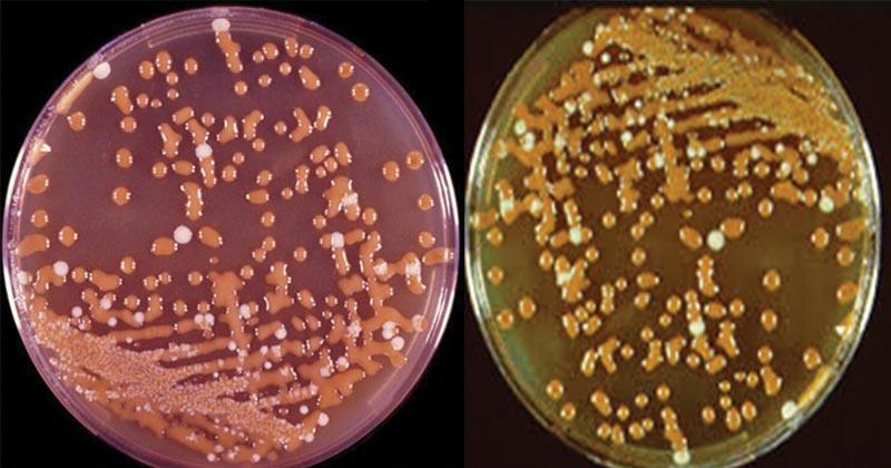 -6 الجنس Cryptococcus من الخمائر البازيدية يتكاثر بالب ارعم من جوانب