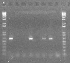 Visualizing the DNA (ethidium bromide) تصور الدنا )بروميد اإليثيديوم( Wells الفتحات DNA ladder الدر الدنا 1 2 3 4 5 6 7 8 DNA ladder الدر الدنا PCR Product
