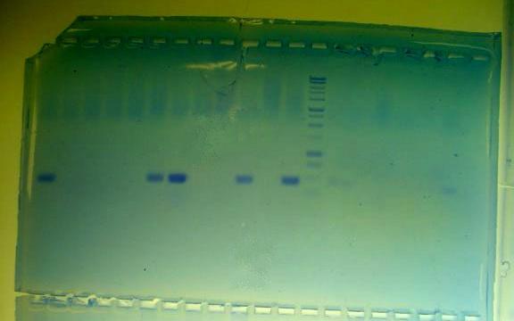 Visualizing the DNA (QuikVIEW stain) تصور الدنا )صبغة كويك فيو ) Wells الفتحات DNA ladder الدر الدنا PCR