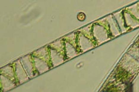 معمل 1 تجربة 1 2 مشاهدة بالستيدات الطحالب في شرائح جاهزة: Spirogyra