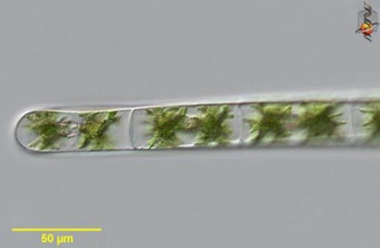 3 Spirogyra Zygnema Allothrix تجربة 1 3 خذ ورقة حشائش خضراء وإبداء